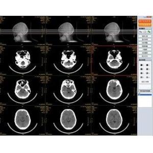 Medical Dry Thermal PET X Ray Film , Agfa Drystar DT2B Fuji Drypix