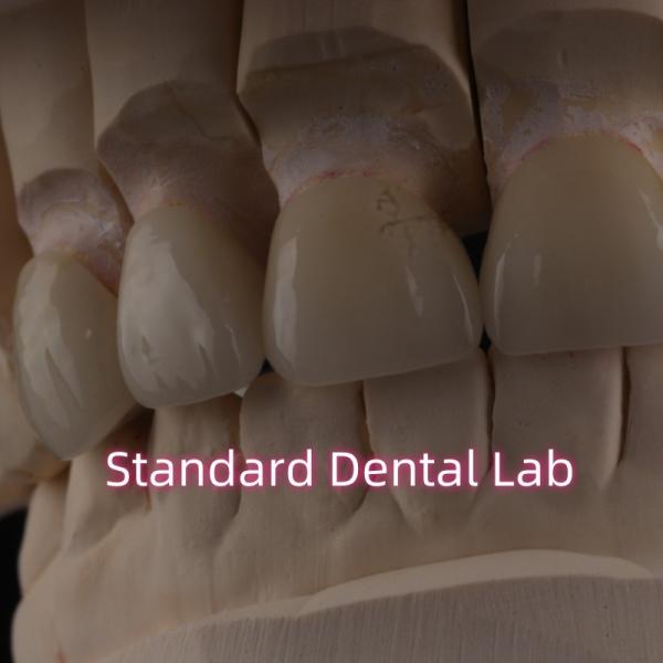 Quality Professional Dental Lab Zirconia Crown For Fixed Restoration for sale