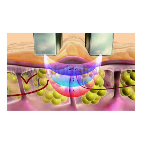 Channeling Optimized RF Skin Tightening Machine With Three Treatment Head