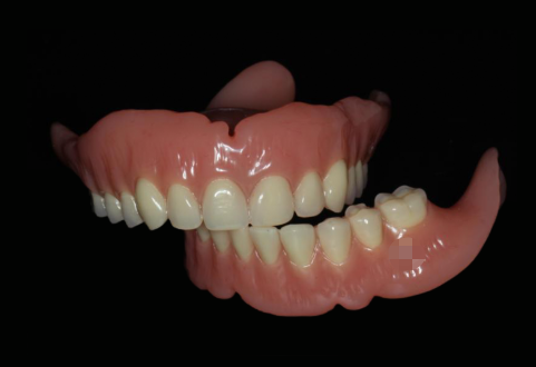 Printed Full Removable Dentures Digital Complete Denture Pink