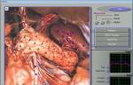 Quantum 3d Nls Health Analyzer , Non-linear Analysis System