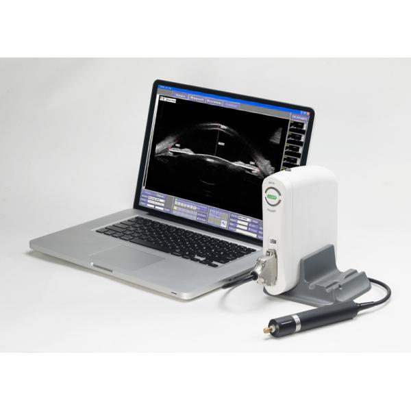 Portable Panoramic Full Scale Ultrasound Bio-microscope UBM Opthalmology