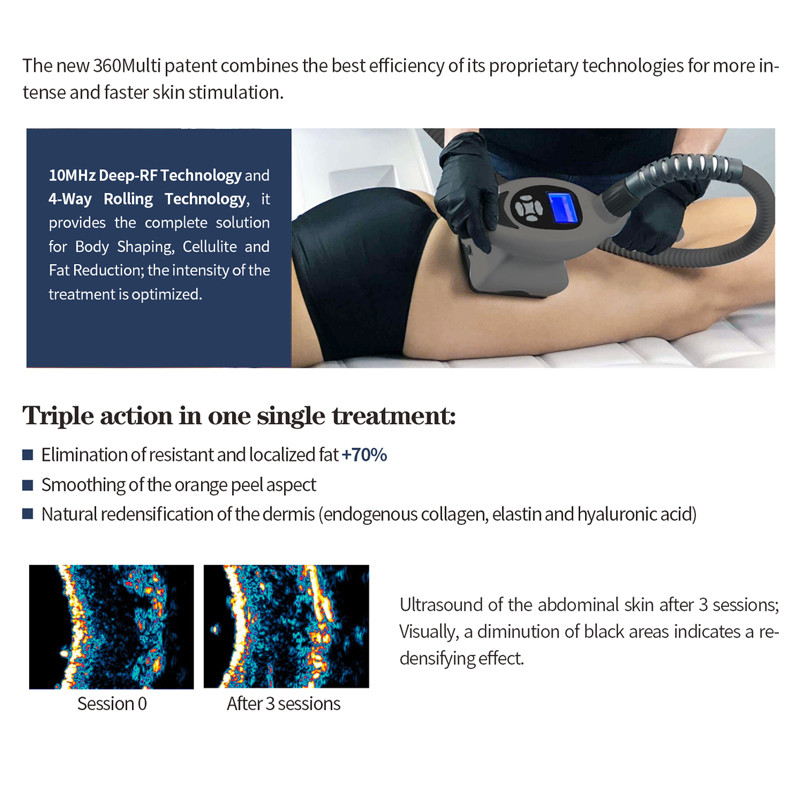 Med-360 Vela Shape Machine Multi Cavitation Slimming With Led Light 700ma No Side Effects