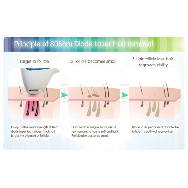 808nm Diode LED Skin Rejuvenation Machine 220v Yag Laser Hair Removal