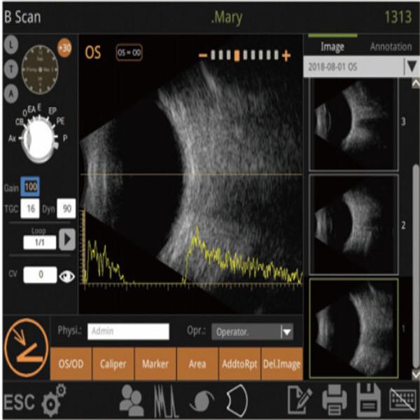 Mini Ultrasound Scanner Machine With Intelligent Digital Software Multiple IOL