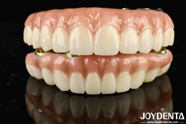 Quality High Durability Ti-Bar Zirconia Hybrid Bridge For Achieving Aesthetics for sale