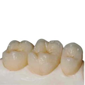 China Computer-aided Manufactured Customized Zirconia Dental Crown wholesale