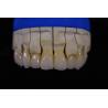 Buy cheap Denture Fabrication Lab Achieving Perfectly White Dentures with Zirconia Repair from wholesalers