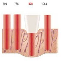 Beauty Salon Beard / Armpit Diode Laser Hair Removal Machine 810nm For Women