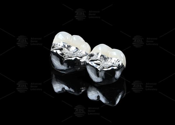 Quality Co Cr Ceramic PFM Restorations Cad Cam Pfm Crown Natural Looking for sale