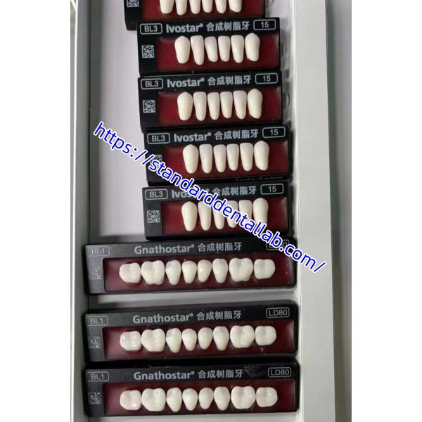 Ace Teeth Pink/Dark TCS Valplast Flexible Partial Dentures for High Esthetics Dental 3D Print Model