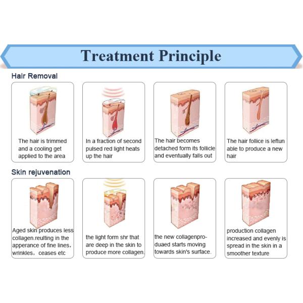 ISO 13485 approved Factory price IPL/SHR hair removal intense pulsed light therapy