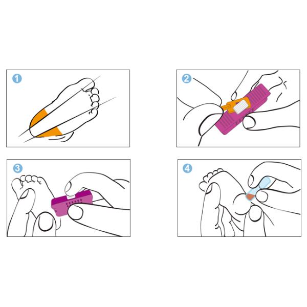 Sterile Newborn Heel Incision Device with Micro Surgical Blade