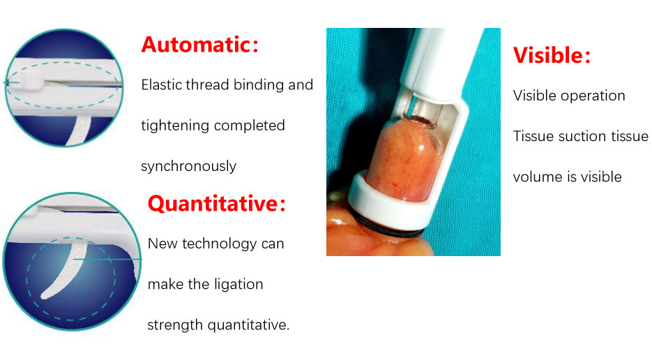 Tighter Binding Disposable Hemorrhoid Ligator With Anoscope New Silica Gel Material