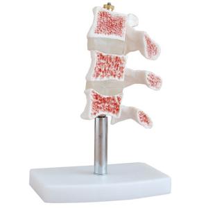 China Hospital Education Osteoporosis 0.4kg Life Size Human Skeleton Model wholesale