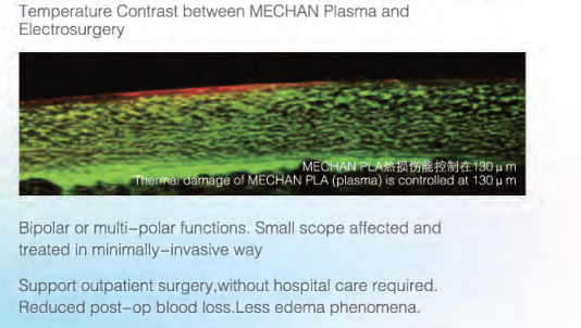 Mechan New Generation of Plasma Generator for Minimally Invasive ENT Surgery -Turbinate Channeling and Ablation