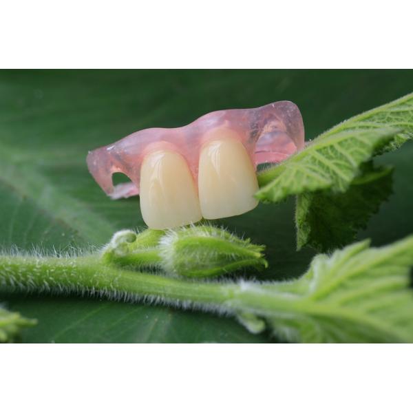 Partial Flexible Invisible Denture For Anterior Teeth