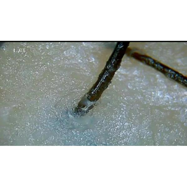 HD 300 Megapixel Skin And Hair Analysis Machine 600X Wireless Hair Scanner Machine