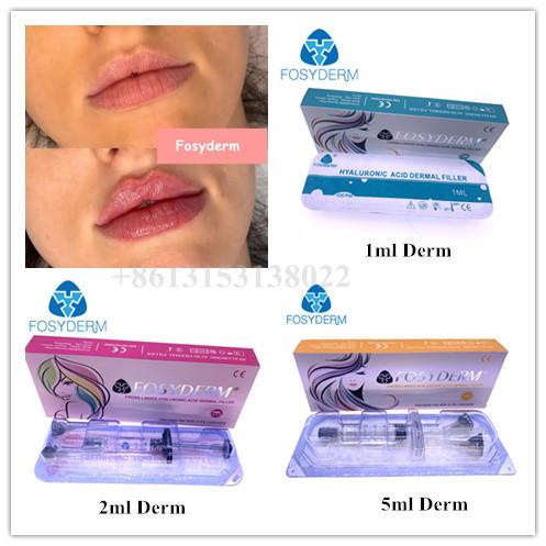 Lip Cheek And Nasolabial Dermal Filler Hyaluronic acid Ha Injections 1ml 2ml 5ml