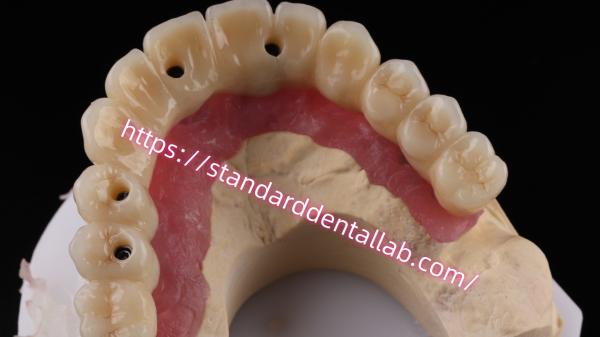 Quality Multi Layer Zirconia Screw Retained Implant Bridge Biocompatible On Metal Structure for sale