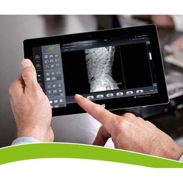 Hot Sell X Ray Machine For Food Mobile X Ray Machine 300ma