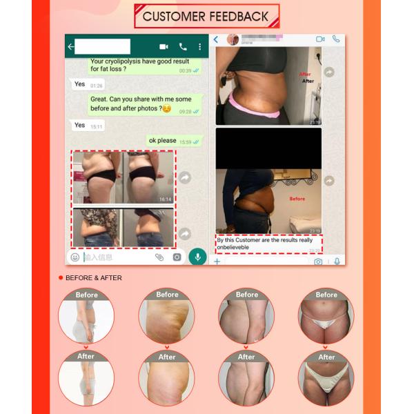 Fat Reduction 2000W 400kpa Cryolipolysis Slimming Machine