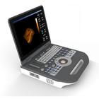 Class II Abdominal Scan Portable Ultrasound Machine PW CFM PDI Mode