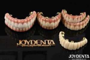 Zirconia for Restoring Chewing Function Optimal Functionality Guaranteed