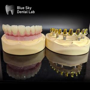 Screw retained MUA abutment Implant Cases Zirconia crowns Multilayer pink porcelain with Easy repair