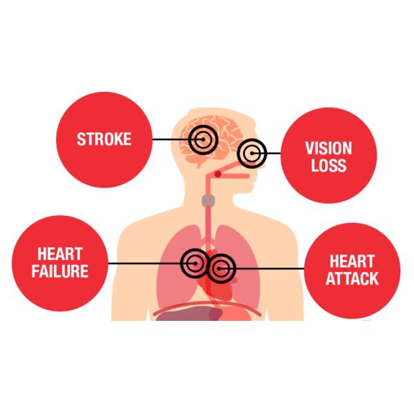 Hypertension Laser Therapy Watch Build In Lithium Battery