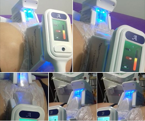 Cool sculpting 6 In 1 Cryolipolysis Cavitation RF Fat Freezing Multi-functional Slimming Machine