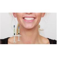 China Plumper Lips Dermal Filler Injection Treatment Hyaluronic Acid Facial Fillers for sale