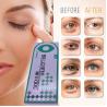 Buy cheap Hyamely Removing Dark Circles Injection Filling Tear Troughs 1ml from wholesalers