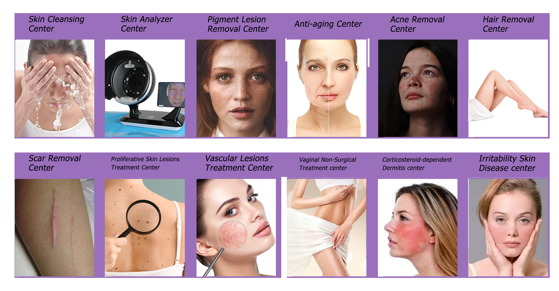 radio frequency device Vacuum liposuction sliming machine shape beauty machine Vacuum roller vela slim