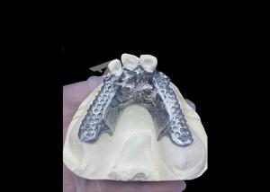 China Easy Fit Custom Cast Partial Denture Stable and Natural-looking Framework for Fast Results wholesale