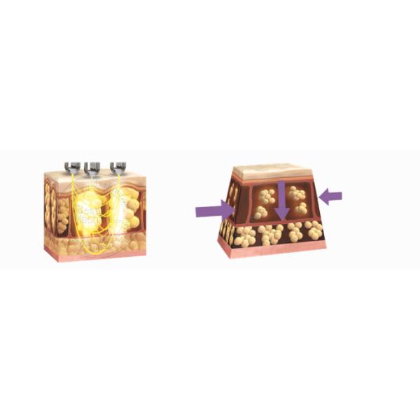new model salon use multifunction vacuum cavitation rf body shaping machine price