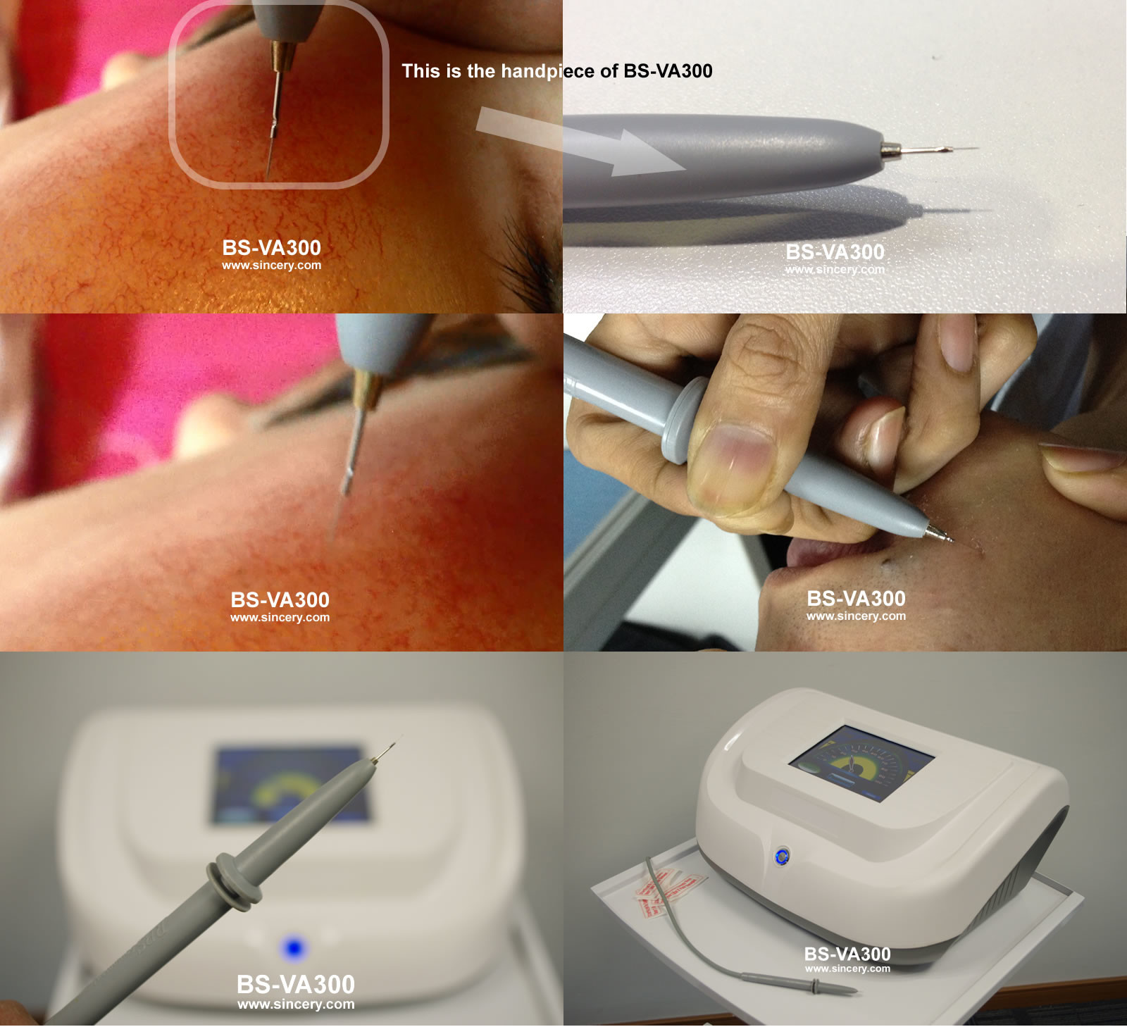 High Frequency Red Blood Vascular Removal Machine With Pulse / Continuous Work Mode