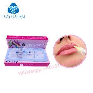 China Fosyderm Hyaluronic Acid Non Invasive Lip Filler Cross Linked HA Fillers wholesale