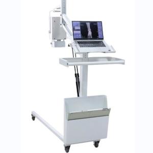 China High Frequency Mobile Digital Radiography Machine Digital X Ray Equipment wholesale