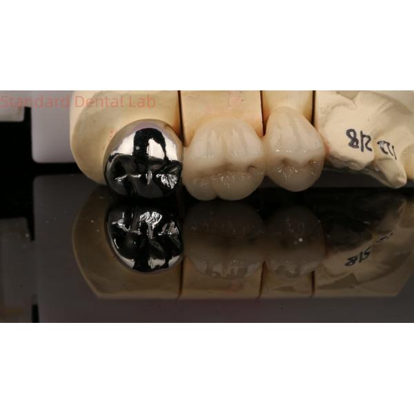 Vita Porcelian Full Metal Crown With Post Core 3 Years Guarantee from Dental Lab