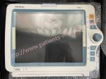Mindray IMEC7 Patient Monitor With ECG RESP NIBP SpO2 PR TEMP Parameters