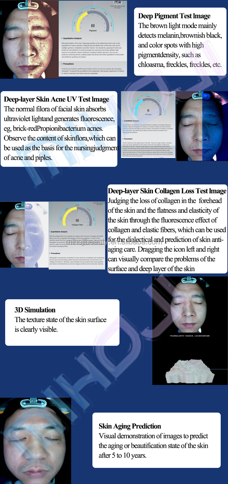 Skin Analyzer with 36 Million Pixels Camera and Pigmentation Analysis Function at Design