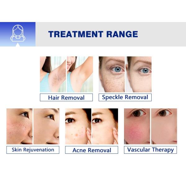IPL OPT Beauty Machine