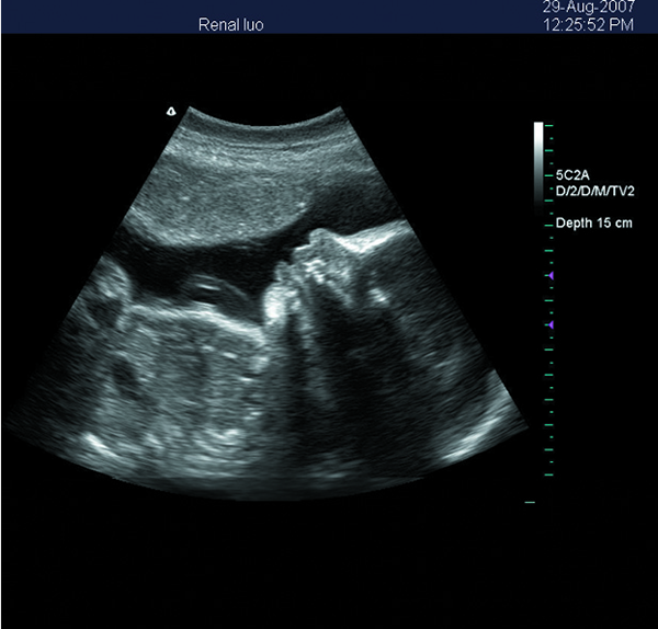 Portable 3D Ultrasound Machine Color Doppler Ultrasound Scanner with 15 Inch LED Screen