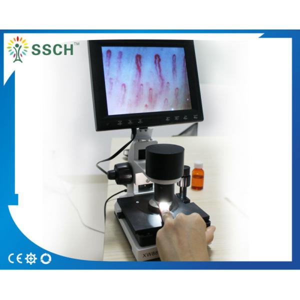 CE Approved LCD Screen Medical Microscope Capillary Microcirculation