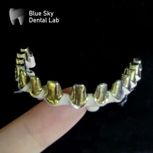 China Silver Gold Universal Pure Titanium Metal Frame Dental Customizable wholesale