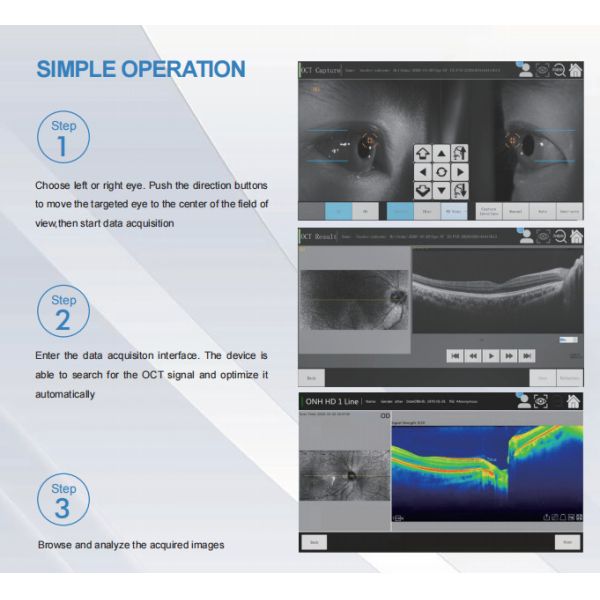 Eye Scanner Optical Coherence Tomography Non Invasive Imaging Device