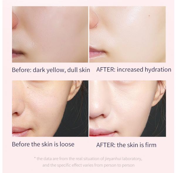 Repairing Hyaluronic Acid Sheet Mask Firming For Sensitive Skins
