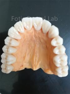 China Advanced Multi Layered Zirconia For Superior Wear And Corrosion Resistance on sale
