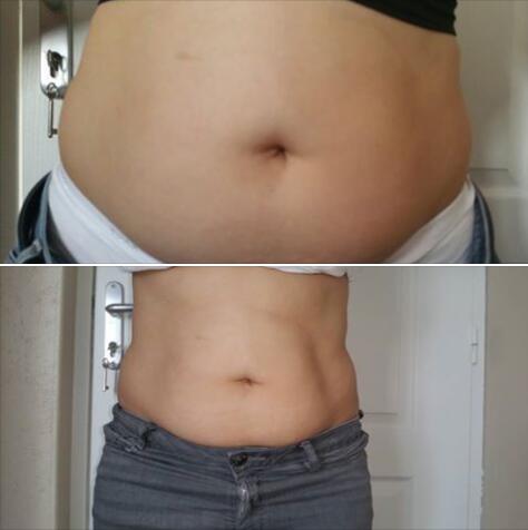 ABS Portable Cryolipolysis Machine / Cryo Slimming Machine For Weight Loss